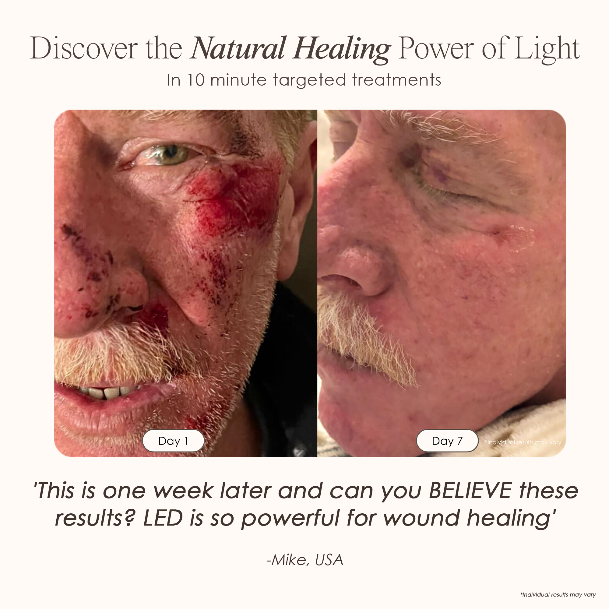 LumaLux Dome | Face & Body LED Red Light Therapy Device