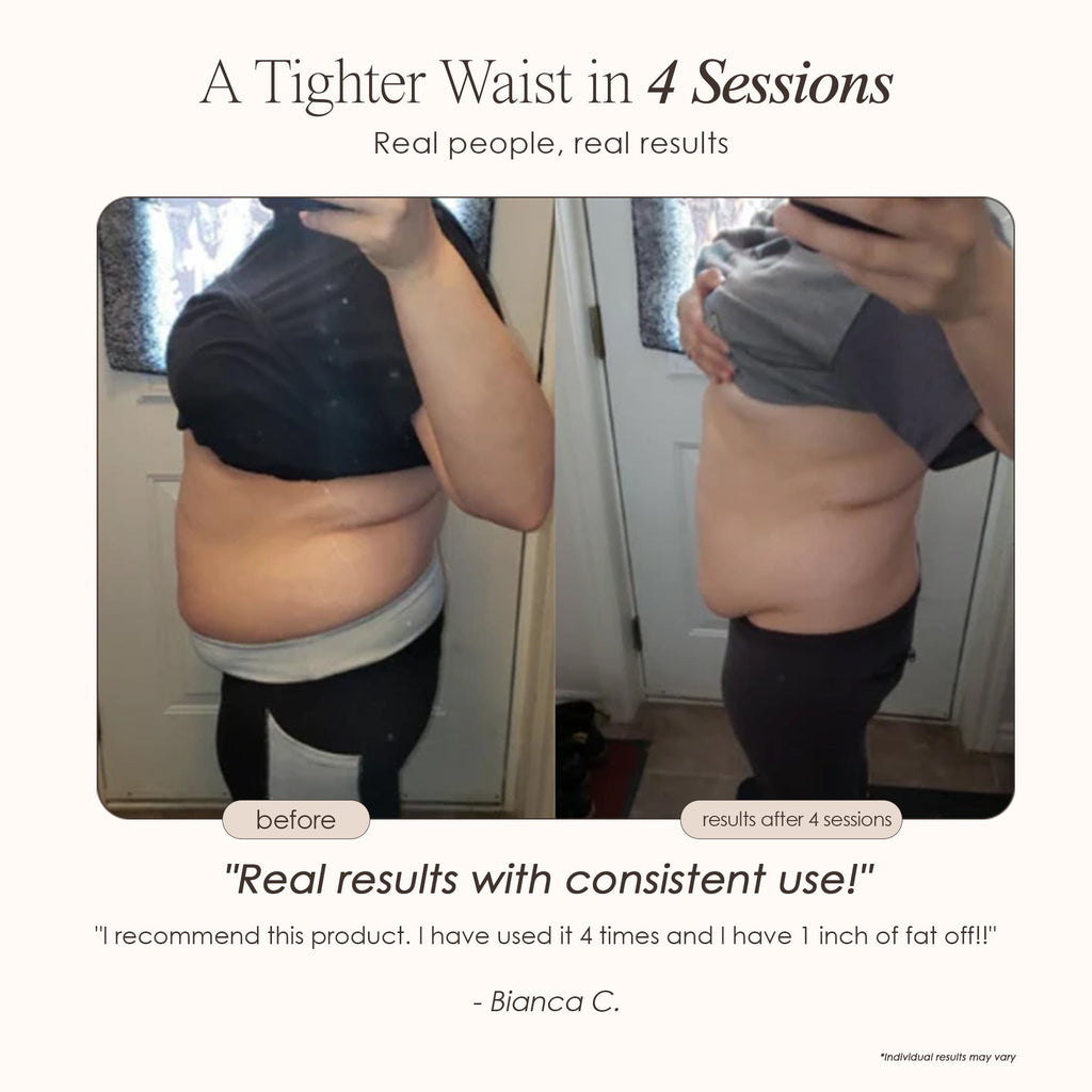 BodySculpt | LED RF Beauty System